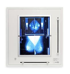 Negatoskop pre mammograms (s clonou) NGP 21m Z 