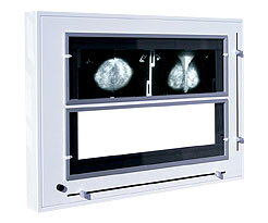 Negatoskop pre mammograms (s clonou) NGP 31 m Z 