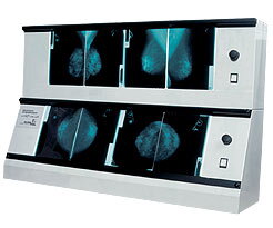 Negatoskop pre mammograms (bez clony) 2x NGP 31m (s úpravou jasu) 