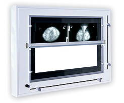 Negatoskop pre mammograms (s clonou) NGP 31m ZU 