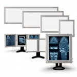 Negatoskop LED NGP 41 SLIM, 4 panelový stolový Negatoskop LED NGP 41 SLIM, 4 panelový stolový